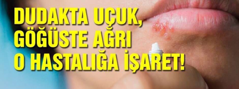 Bu belirtilere dikkat! Dudakta uçuk, göğüste ağrı o hastalığa işaret