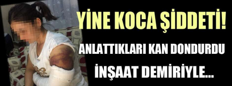 Yine koca şiddeti! Anlattıkları kan dondurdu