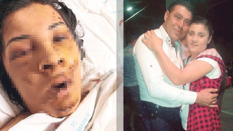 22 dişini kıran kocasını mahkemede görünce korkudan bayıldı!