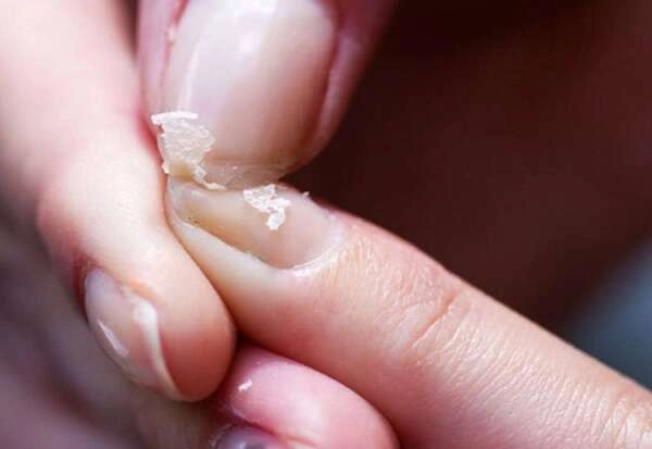 Tırnağı böyle olanlar dikkat !