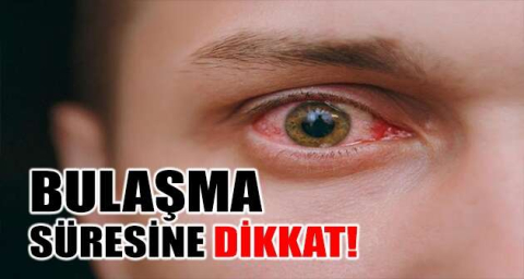 Bulaşma süresine dikkat!