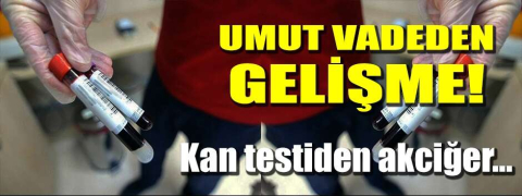 Umut vadeden gelişme!