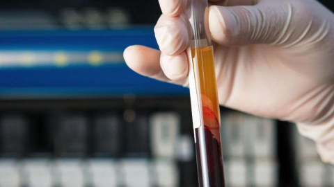 Tek dozu 28 bin lira!