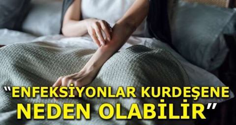“Enfeksiyonlar kurdeşene neden olabilir”
