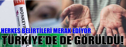 Türkiye’de de görüldü! 